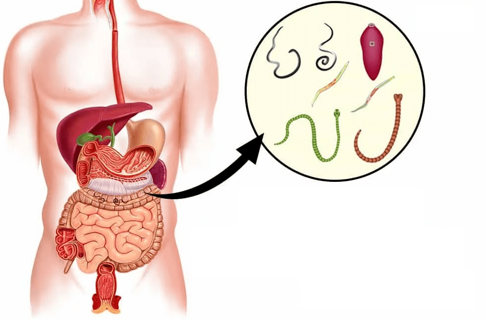 Helmintos e vermes no trato gastrointestinal