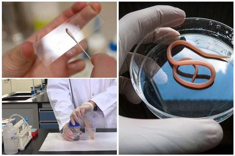 testes para a presença de vermes no corpo