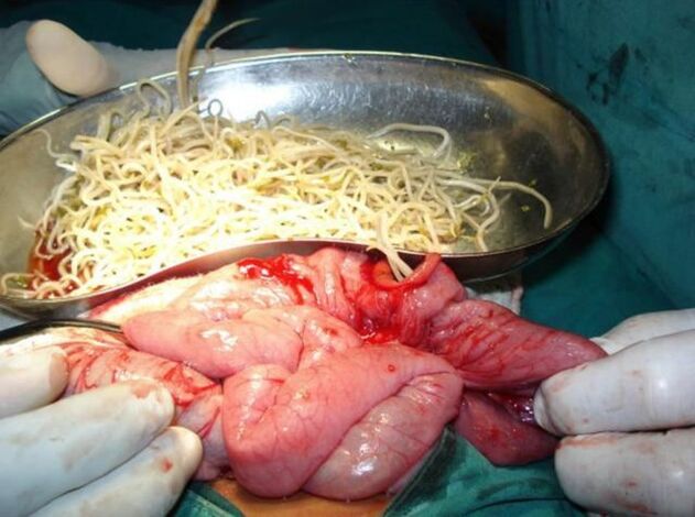 Parasitas intestinais